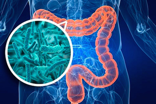 Microbioma e intestino permeabile (leaky gut)